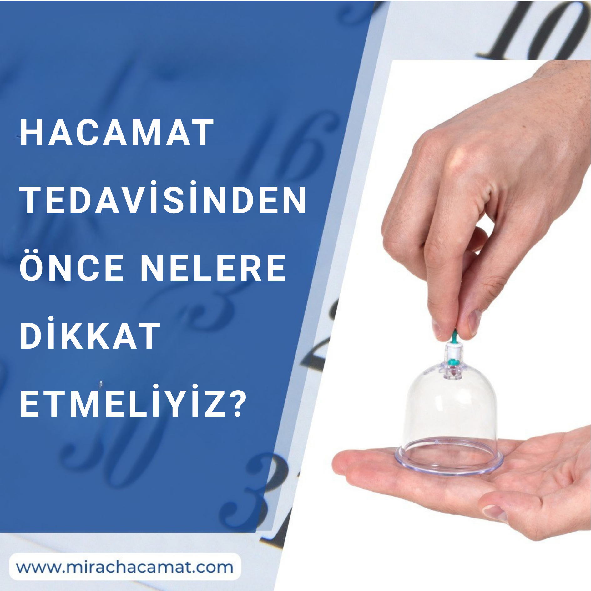 Hacamat Tedavisinden Önce Nelere Dikkat Etmeliyiz?