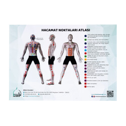 Atlas der Schröpfpunkte - 3