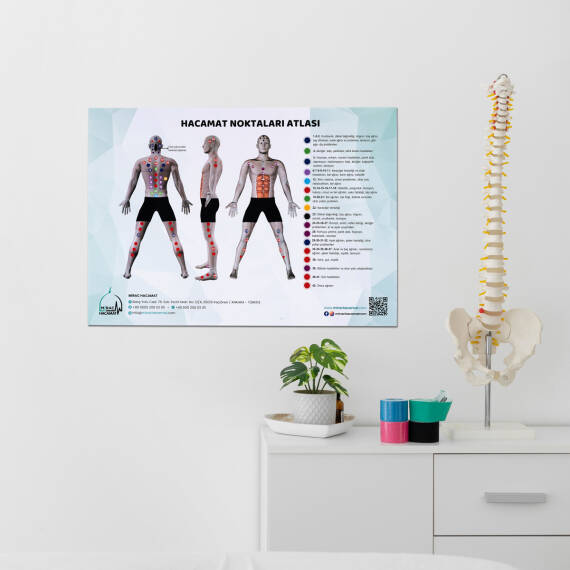 Atlas of Cupping Points - 4